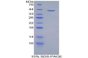 SDS-PAGE of Protein Standard from the Kit (Highly purified E. (Amphiregulin CLIA Kit)