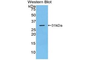 Western blot analysis of the recombinant protein. (TRADD 抗体  (AA 24-261))