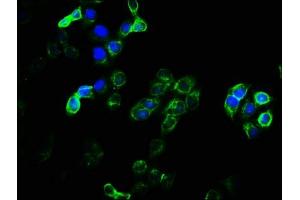 Immunofluorescence staining of Hela cells with ABIN7151986 at 1:100, counter-stained with DAPI. (EMC9 抗体  (AA 1-208))