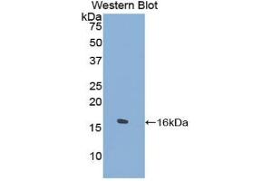 Western blot analysis of the recombinant protein. (TPSD1 抗体  (AA 99-191))