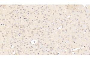 Immunohistochemistry (IHC) image for anti-Calcium Channel, Voltage-Dependent, L Type, alpha 1C Subunit (CACNA1C) (AA 1978-2139) antibody (ABIN7441256)
