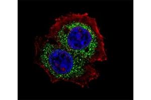 Fluorescent confocal image of MCF-7 cell stained with Estrogen Receptor antibody at 1:25.