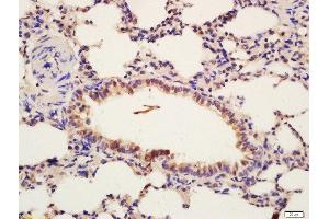 Formalin-fixed and paraffin embedded mouse lung labeled with Rabbit Anti-Insulin Receptor Beta (Tyr1185) Polyclonal Antibody, Unconjugated  at 1:200 followed by conjugation to the secondary antibody and DAB staining (ISR-beta 抗体  (pTyr1185))