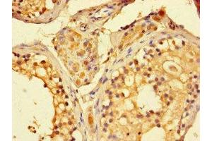 Immunohistochemistry of paraffin-embedded human testis tissue using ABIN7160851 at dilution of 1:100 (SIRT1 抗体  (AA 2-747))