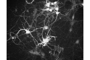 Immunochemical staining of cultured mouse caudate neurons with Ppp1r1b polyclonal antibody . (DARPP32 抗体  (N-Term))