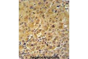 Immunohistochemistry (IHC) image for anti-FK506 Binding Protein 1A, 12kDa (FKBP1A) antibody (ABIN3003472) (FKBP1A 抗体)