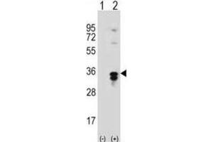 Western Blotting (WB) image for anti-Palmitoyl-Protein Thioesterase 1 (PPT1) antibody (ABIN3001553) (PPT1 抗体)