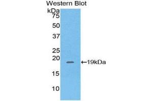 Western Blotting (WB) image for anti-Pleckstrin Homology-Like Domain, Family A, Member 2 (PHLDA2) (AA 9-140) antibody (ABIN1860206) (PHLDA2 抗体  (AA 9-140))