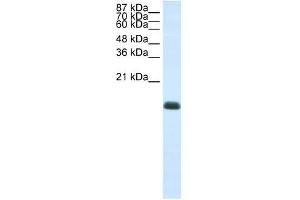 ZNF786 antibody (20R-1235) used at 0. (ZNF786 抗体  (N-Term))