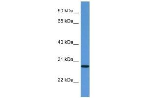 Western Blot showing EDN3 antibody used at a concentration of 1 ug/ml against Fetal Kidney Lysate (Endothelin 3 抗体  (C-Term))