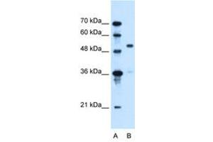 Image no. 2 for anti-Solute Carrier Family 37 (Glycerol-3-Phosphate Transporter), Member 3 (SLC37A3) (AA 224-273) antibody (ABIN6736664) (SLC37A3 抗体  (AA 224-273))