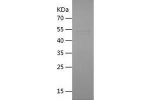 PODXL Protein (AA 22-301) (His-IF2DI Tag)