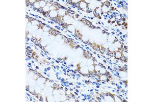 Immunohistochemistry of paraffin-embedded human colon using GIP antibody (ABIN1882357) at dilution of 1:100 (40x lens). (GIP 抗体)