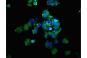 Immunofluorescent analysis of HepG2 cells using ABIN7149779 at dilution of 1:100 and Alexa Fluor 488-congugated AffiniPure Goat Anti-Rabbit IgG(H+L) (Desmoglein 2 抗体  (AA 183-331))