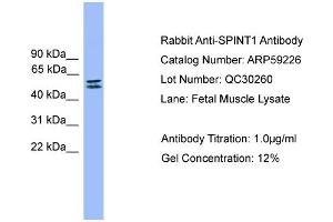 WB Suggested Anti-SPINT1  Antibody Titration: 0. (SPINT1 抗体  (C-Term))