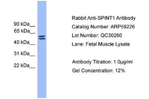 Western Blotting (WB) image for anti-serine Peptidase Inhibitor, Kunitz Type 1 (SPINT1) (C-Term) antibody (ABIN2787982)