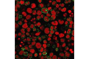 Immunofluorescence staining of MOLT-4 cells using CD2 Mouse Monoclonal Antibody (1E7E8. (CD2 抗体)