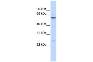 IGFALS antibody used at 1 ug/ml to detect target protein.