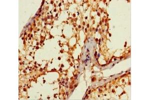 Immunohistochemistry of paraffin-embedded human testis tissue using ABIN7144155 at dilution of 1:100 (ANKDD1A 抗体  (AA 272-490))