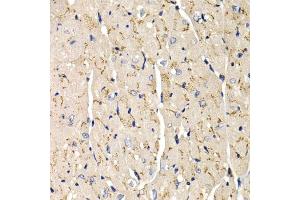 Immunohistochemistry of paraffin-embedded mouse heart using SFRP2 antibody (ABIN6131355, ABIN6147675, ABIN6147677 and ABIN6221030) at dilution of 1:200 (40x lens). (SFRP2 抗体  (AA 25-295))
