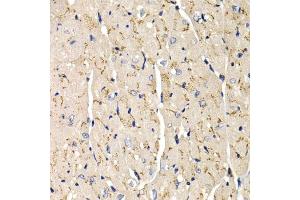 Immunohistochemistry of paraffin-embedded mouse heart using SFRP2 antibody (ABIN6131355, ABIN6147675, ABIN6147677 and ABIN6221030) at dilution of 1:200 (40x lens). (SFRP2 抗体  (AA 25-295))