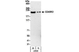 Western Blotting (WB) image for anti-CD45RO (CD45RO) antibody (ABIN7449553) (CD45RO 抗体)