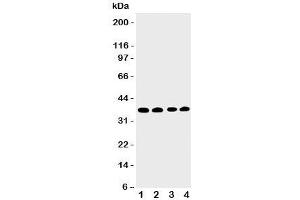 Western blot testing of EIF2S1 antbody; Lane 1: COLO320;  2: CEM;  3: Raji;  4: HT1080 cell lysate. (EIF2S1 抗体  (Middle Region))