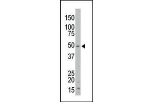 The anti-STK35 Pab is used in Western blot to detect STK35 in mouse kidney tissue lysate. (STK35 抗体  (Middle Region))