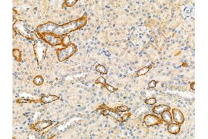 anti-Transforming, Acidic Coiled-Coil Containing Protein 3 (TACC3) (C-Term) antibody