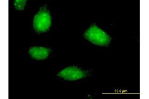 Immunofluorescence of purified MaxPab antibody to SESN1 on HeLa cell. (SESN1 抗体  (AA 1-551))