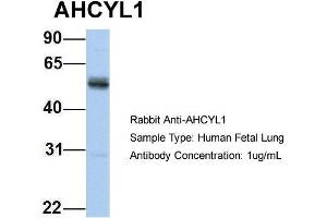Host: Rabbit Target Name: AHCYL1 Sample Type: Human Fetal Lung Antibody Dilution: 1. (AHCYL1 抗体  (N-Term))