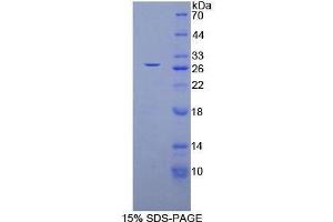 SDS-PAGE (SDS) image for Glutathione S-Transferase mu 4 (GSTM4) (AA 18-215) protein (His tag) (ABIN1878565) (GSTM4 Protein (AA 18-215) (His tag))