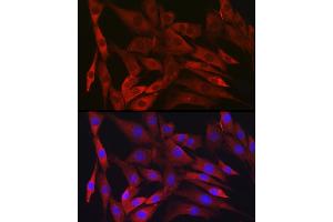 Immunofluorescence (IF) image for anti-Inhibitor of kappa Light Polypeptide Gene Enhancer in B-Cells, Kinase beta (IKBKB) antibody (ABIN7267873)