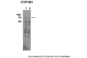 Western Blotting (WB) image for anti-Cytochrome P450, Family 11, Subfamily B, Polypeptide 1 (CYP11B1) (C-Term) antibody (ABIN2788349)