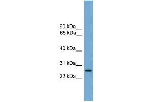 WB Suggested Anti-LRRC3 Antibody Titration:  0. (LRRC3 抗体  (Middle Region))