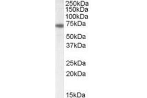 Western Blotting (WB) image for anti-Netrin 1 (NTN1) (C-Term) antibody (ABIN2464806) (Netrin 1 抗体  (C-Term))