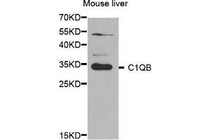 Western Blotting (WB) image for anti-Complement Component 1, Q Subcomponent, B Chain (C1QB) antibody (ABIN1876527) (C1QB 抗体)