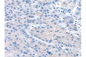 Immunohistochemistry (IHC) image for anti-Uncoupling Protein 2 (Mitochondrial, Proton Carrier) (UCP2) antibody (ABIN5958545) (UCP2 抗体)