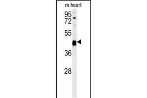 Western blot analysis in mouse heart tissue lysates (15ug/lane). (TINAGL1 抗体  (C-Term))