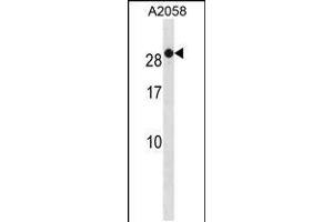 Western blot analysis in A2058 cell line lysates (35ug/lane). (RAB7B 抗体  (C-Term))