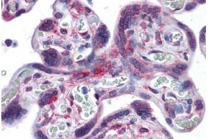 Human Placenta: Formalin-Fixed, Paraffin-Embedded (FFPE) (RPS7 抗体  (AA 95-195))