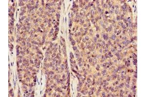 Immunohistochemistry (IHC) image for anti-Solute Carrier Family 2 (Facilitated Glucose Transporter), Member 1 (SLC2A1) (AA 263-458) antibody (ABIN7170002)