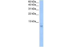 Septin 6 antibody used at 0. (Septin 6 抗体  (N-Term))
