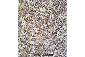 Immunohistochemistry (Paraffin-embedded Sections) (IHC (p)) image for anti-Immune Receptor Expressed On Myeloid Cells 1 (IREM1) (AA 63-92), (N-Term) antibody (ABIN951573)
