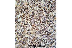 CLM1 Antibody (N-term) immunohistochemistry analysis in formalin fixed and paraffin embedded human lymph tissue followed by peroxidase conjugation of the secondary antibody and DAB staining. (IREM1 抗体  (N-Term))