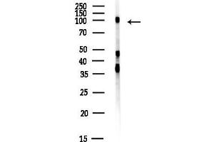 anti-SCY1-Like 1 (SCYL1) antibody