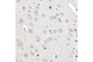 Immunohistochemistry of paraffin-embedded Rat brain using CNOT7 Rabbit pAb (ABIN6127563, ABIN6138783, ABIN6138784 and ABIN6224834) at dilution of 1:50 (40x lens). (CNOT7 抗体  (AA 90-160))