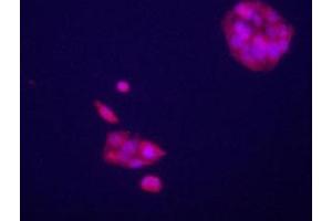Immunofluorecence staining of GPC3 antibody on HepG2 cells. (Glypican 3 抗体  (AA 529-560))