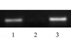 Histone H4 acetyl Lys5 antibody tested by ChIP. (Histone H4 抗体  (acLys5))