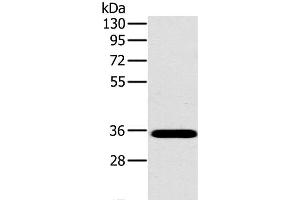 Western Blot analysis of Mouse brain tissue using OTUB1 Polyclonal Antibody at dilution of 1:800